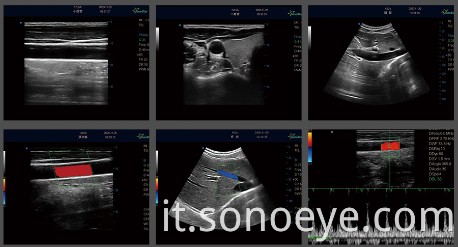 mini ultrasound